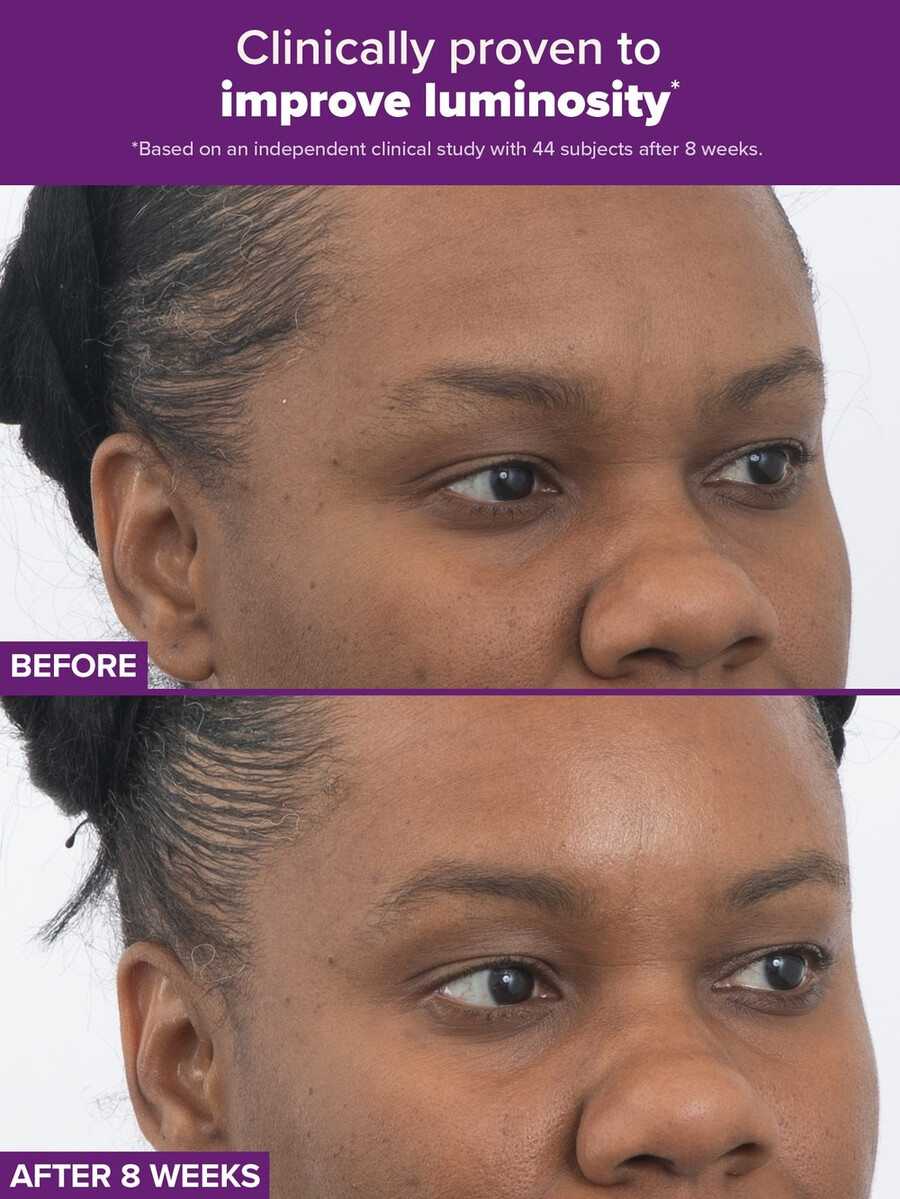 clinical pro retinaldehid dvostruki retinoidni tretman